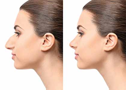 7 Best Exercises For A Sharper Nose
